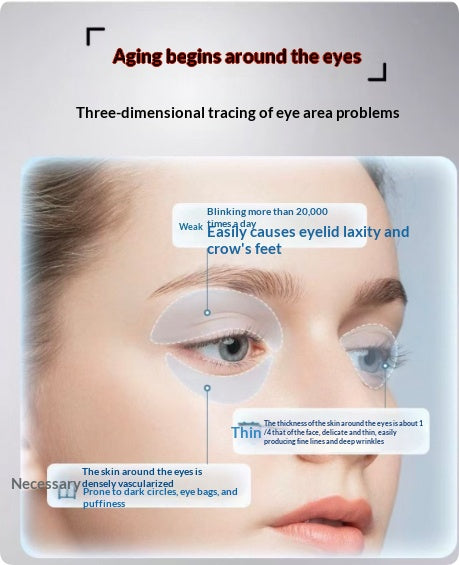 Eye Massager with Heat Therapy for Eye Bags and Dark Circles